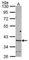 Hyaluronan and proteoglycan link protein 2 antibody, NBP2-16779, Novus Biologicals, Western Blot image 
