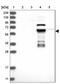Zinc Finger Protein 490 antibody, NBP1-81432, Novus Biologicals, Western Blot image 