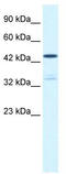 Ckbeta3 antibody, TA338542, Origene, Western Blot image 