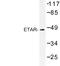 Endothelin Receptor Type A antibody, LS-C177397, Lifespan Biosciences, Western Blot image 