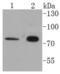 Keratin 1 antibody, NBP2-67681, Novus Biologicals, Western Blot image 