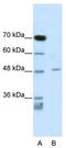 Calcium Voltage-Gated Channel Auxiliary Subunit Beta 4 antibody, TA338347, Origene, Western Blot image 