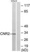 Cannabinoid Receptor 2 antibody, TA313148, Origene, Western Blot image 