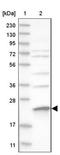 Mitochondrial Ribosomal Protein S23 antibody, NBP1-84518, Novus Biologicals, Western Blot image 