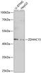 Zinc Finger DHHC-Type Containing 15 antibody, 15-552, ProSci, Western Blot image 