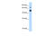 GTPase Activating Protein And VPS9 Domains 1 antibody, 29-751, ProSci, Western Blot image 