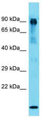 Methylmalonyl-CoA Mutase antibody, TA335135, Origene, Western Blot image 