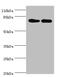LHRHR antibody, A50338-100, Epigentek, Western Blot image 
