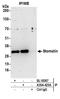 STOM antibody, A304-425A, Bethyl Labs, Immunoprecipitation image 