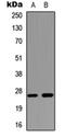 Aquaporin 2 antibody, orb235021, Biorbyt, Western Blot image 