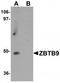 Zinc Finger And BTB Domain Containing 9 antibody, TA320149, Origene, Western Blot image 