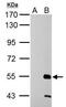 ERCC Excision Repair 6 Like 2 antibody, PA5-34915, Invitrogen Antibodies, Western Blot image 