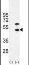 Creatine kinase M-type antibody, PA5-13829, Invitrogen Antibodies, Western Blot image 