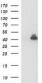 Parvin Alpha antibody, TA505989AM, Origene, Western Blot image 