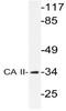 Carbonic anhydrase 2 antibody, AP20569PU-N, Origene, Western Blot image 