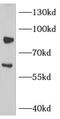 NADPH oxidase 5 antibody, FNab05807, FineTest, Immunohistochemistry paraffin image 