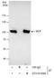 Valosin Containing Protein antibody, GTX101089, GeneTex, Immunoprecipitation image 