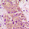 BCL2 Associated Agonist Of Cell Death antibody, LS-C358435, Lifespan Biosciences, Immunohistochemistry frozen image 