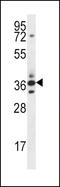 Secreted frizzled-related protein 5 antibody, LS-B9284, Lifespan Biosciences, Western Blot image 