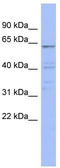 Zinc Finger Protein 689 antibody, TA345499, Origene, Western Blot image 