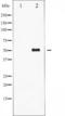 Vimentin antibody, TA325973, Origene, Western Blot image 