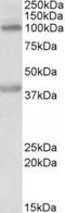 Zinc Finger E-Box Binding Homeobox 2 antibody, TA311426, Origene, Western Blot image 