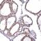 MAK16 Homolog antibody, NBP2-47385, Novus Biologicals, Immunohistochemistry paraffin image 