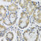 Mitochondrial Ribosomal Protein L1 antibody, STJ26977, St John