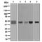 Pentraxin 3 antibody, ab125007, Abcam, Western Blot image 