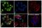 Nucleolin antibody, PA3-16875, Invitrogen Antibodies, Immunofluorescence image 
