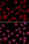 CD3 antibody, LS-C331677, Lifespan Biosciences, Immunofluorescence image 