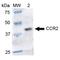 C-C Motif Chemokine Receptor 2 antibody, LS-C773718, Lifespan Biosciences, Western Blot image 