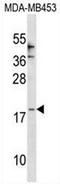 C-C Motif Chemokine Ligand 25 antibody, AP50803PU-N, Origene, Western Blot image 