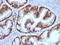 Estrogen Receptor 1 antibody, AE00172, Aeonian Biotech, Immunohistochemistry frozen image 
