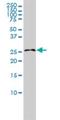 RAS Like Family 11 Member B antibody, H00065997-M01, Novus Biologicals, Western Blot image 