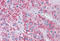 Metastasis Associated 1 antibody, MBS247408, MyBioSource, Immunohistochemistry paraffin image 
