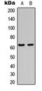 Fos Proto-Oncogene, AP-1 Transcription Factor Subunit antibody, orb256537, Biorbyt, Western Blot image 