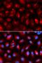 Kinesin Light Chain 1 antibody, LS-C334131, Lifespan Biosciences, Immunofluorescence image 