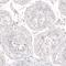 Nanog Homeobox antibody, NBP2-61429, Novus Biologicals, Immunohistochemistry paraffin image 