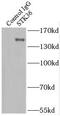 Serine/Threonine Kinase 36 antibody, FNab08335, FineTest, Immunoprecipitation image 