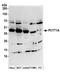 Choline-phosphate cytidylyltransferase A antibody, A304-559A, Bethyl Labs, Western Blot image 