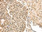 Sterile Alpha Motif Domain Containing 3 antibody, CSB-PA930566, Cusabio, Immunohistochemistry paraffin image 