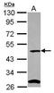 Chromosome 9 Open Reading Frame 43 antibody, PA5-31617, Invitrogen Antibodies, Western Blot image 