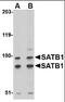 DNA-binding protein SATB1 antibody, orb88373, Biorbyt, Western Blot image 