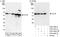 Chaperonin Containing TCP1 Subunit 8 antibody, A303-447A, Bethyl Labs, Western Blot image 