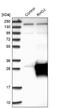 Rho-related GTP-binding protein RhoJ antibody, NBP1-89012, Novus Biologicals, Western Blot image 