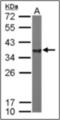 Noggin antibody, orb100968, Biorbyt, Western Blot image 
