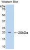 Sex Hormone Binding Globulin antibody, LS-C305177, Lifespan Biosciences, Western Blot image 