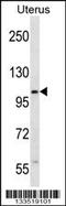 Zinc Finger SWIM-Type Containing 5 antibody, MBS9202811, MyBioSource, Western Blot image 