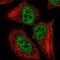 CaRF antibody, NBP2-55694, Novus Biologicals, Immunofluorescence image 